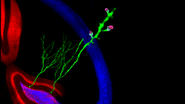 Newborn neurons