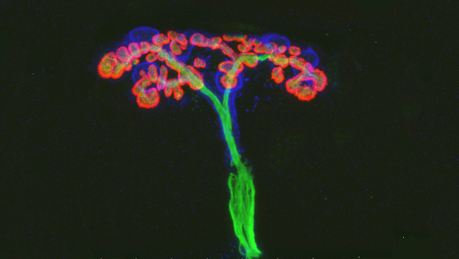 Neuromuscular junction in a mouse