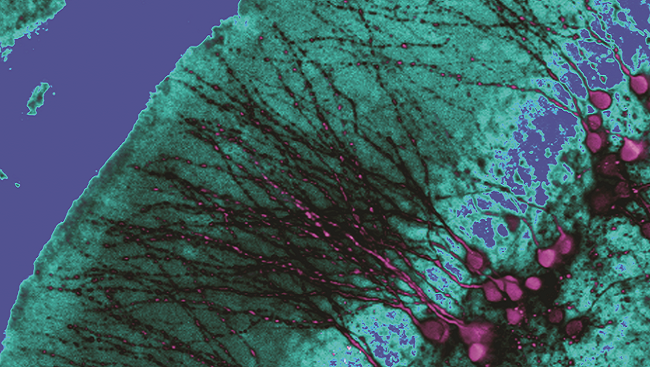 New cells in the hippocampus of a human mouse.