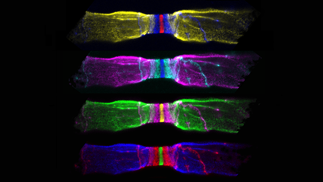 Myelin — a fatty material that wraps around axons (pictured on the left and right of nerve fibers above) — preserves the strength of these signals, allowing them to move quickly along the axon. At each node, or gap in the myelin sheath (center above), electrical signals are amplified, allowing the signal to jump to the next node.