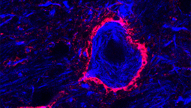 Called perineuronal nets (and pictured here in pink in a mouse brain), these structures help inhibit the signals between neurons and keep current connections intact. 