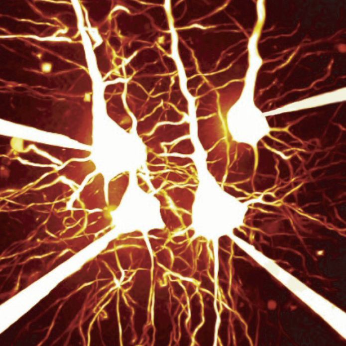 Image of pyramidal cells