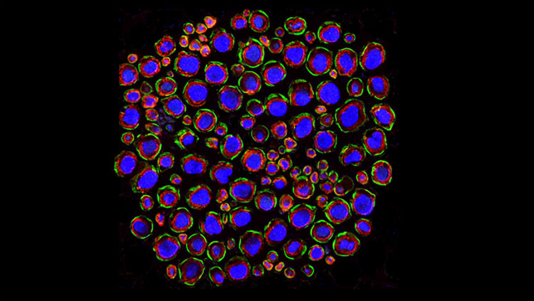 A cross section through a mouse quadriceps nerve showing discontinuous Drp2 staining (green) in the plasma membrane of Schwann cells, with axons stained for neurofilament (blue) and myelin stained for P0 (red). For more information, see the article by C. Stewart Gillespie, and Peter J. Brophy in The Journal of Neuroscience.