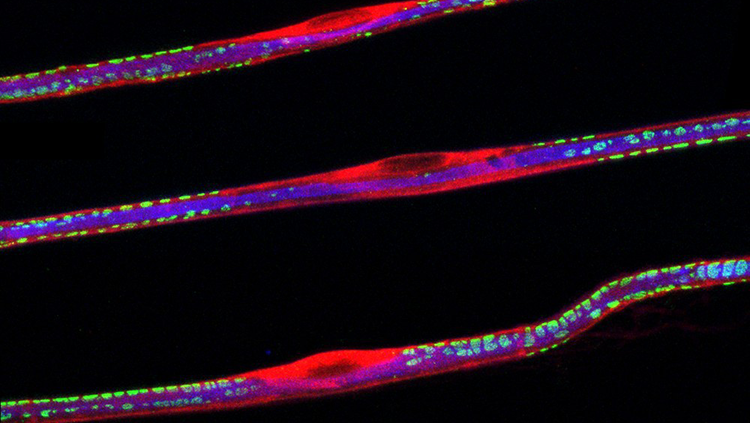 Image of a sciatic nerve