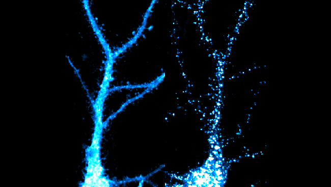 In this image of neurons in a rat hippocampus — a part of the brain involved in learning and memory — enzymes (white and blue dots) mark these unwanted proteins with a tag so that the cell knows to destroy them. 