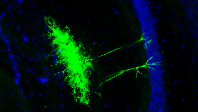 Image of neural cells