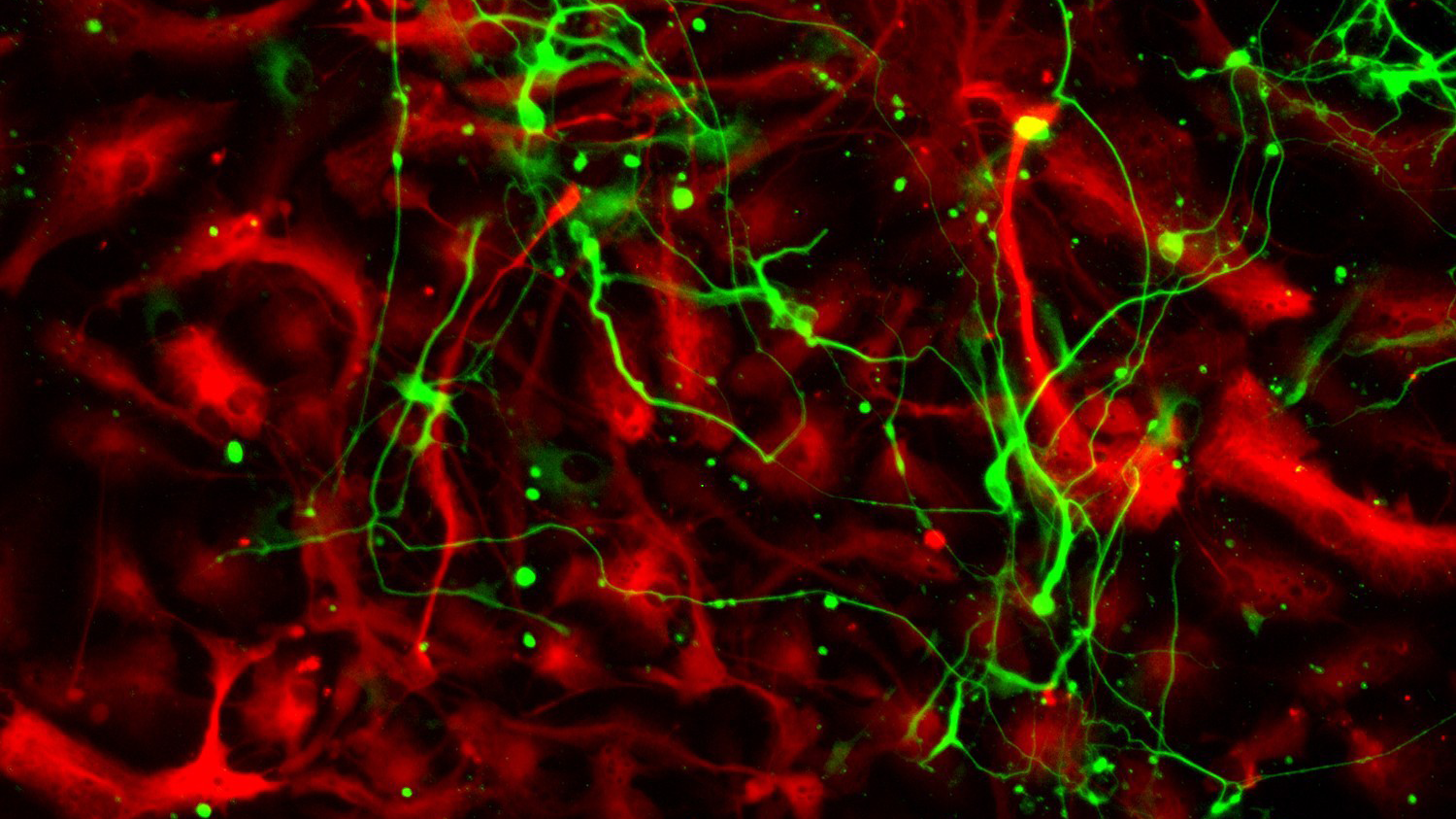 Image of astrocytes in red and some green