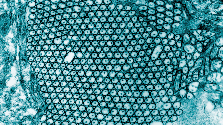 They may look like frog eggs, but these dotted circles are slices of axons that stretch inches or even feet throughout your body.