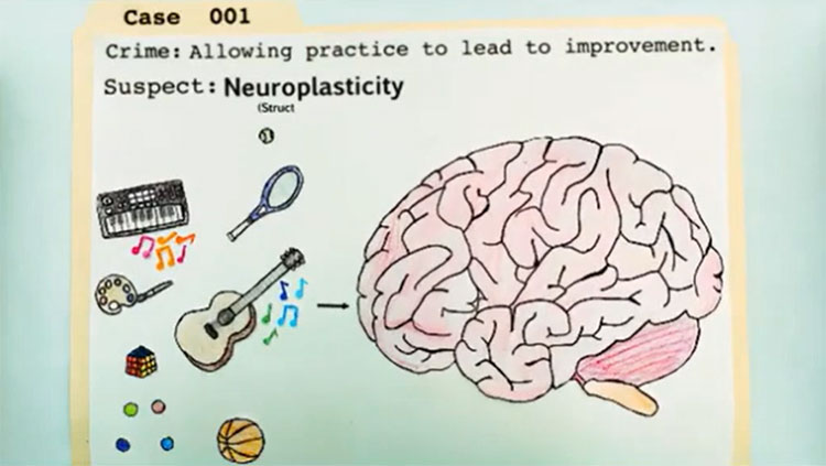 case 001 brain