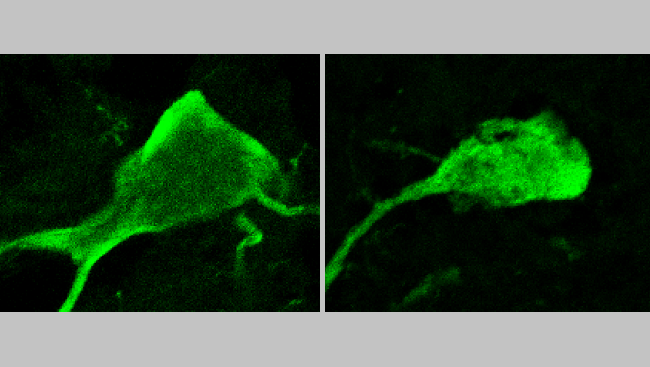 Dopamine neurons