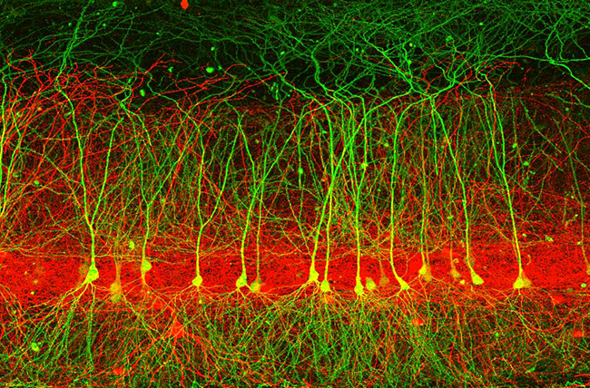 Pyramidal neuron (colored green) can receive tens of thousands of synapses from neurons belonging to several different brain regions. Interneurons (colored red) form local connections onto pyramidal neurons to form specific microcircuits. 