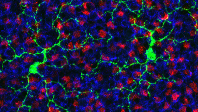 This image of a mouse retina shows microglia (green) interacting with the synapses formed by axon terminals (red) and dendrites (blue). 