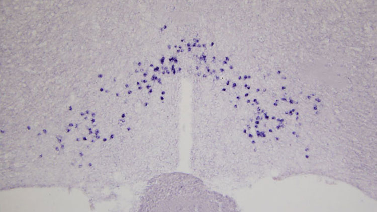 Evolution of Mammalian Opn5 