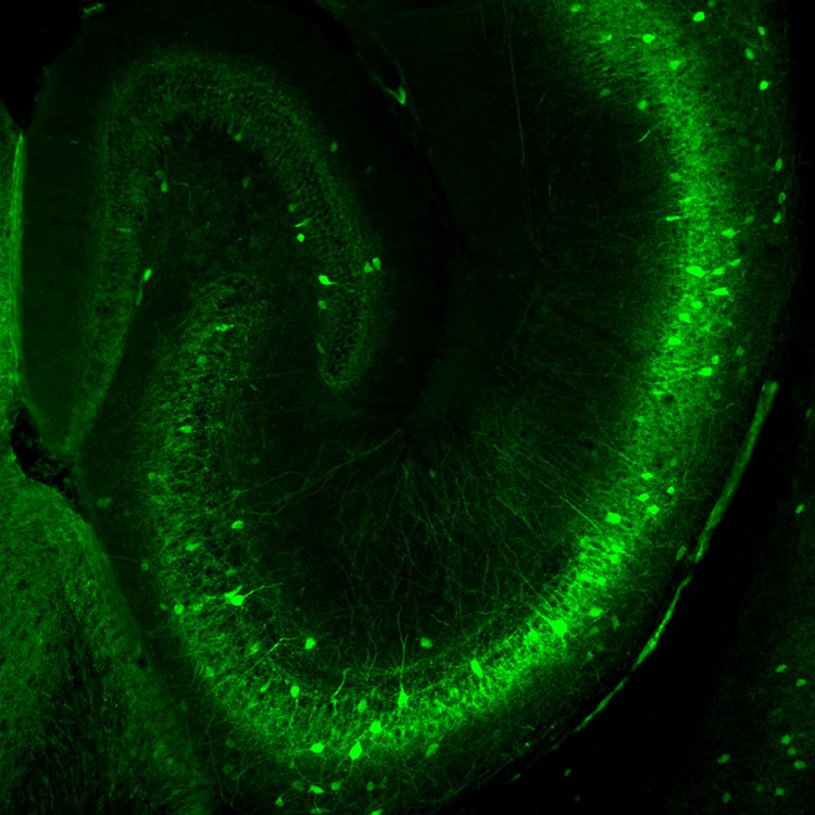 Interneurons of the mouse hippocampus
