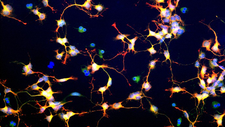 image of a neuroblast, multi-colored
