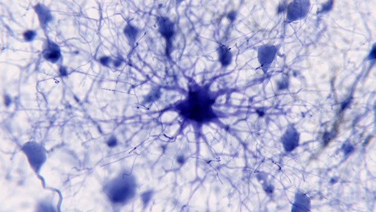 Image of purple neuron