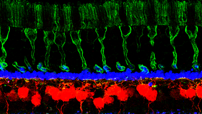 Macaque monkey retina