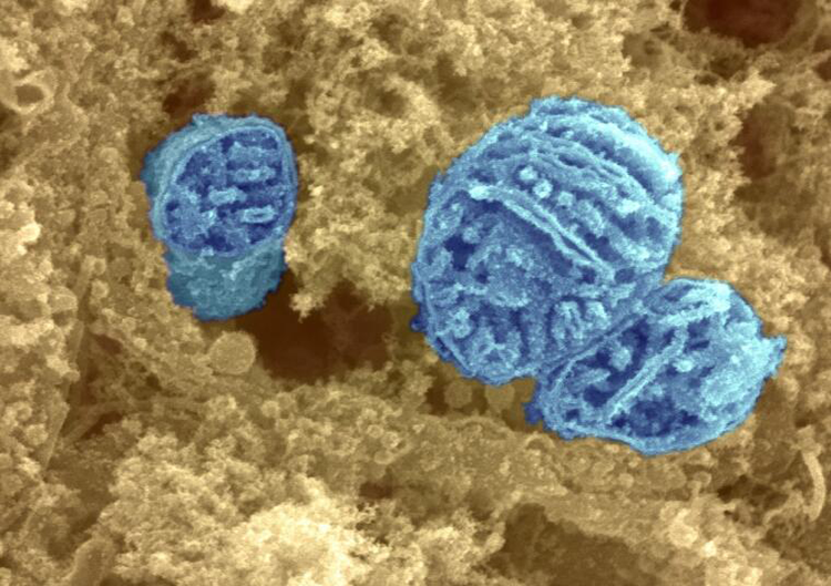 Mitochondria cells