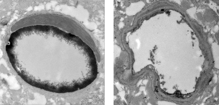 Blood brain barrier in mice