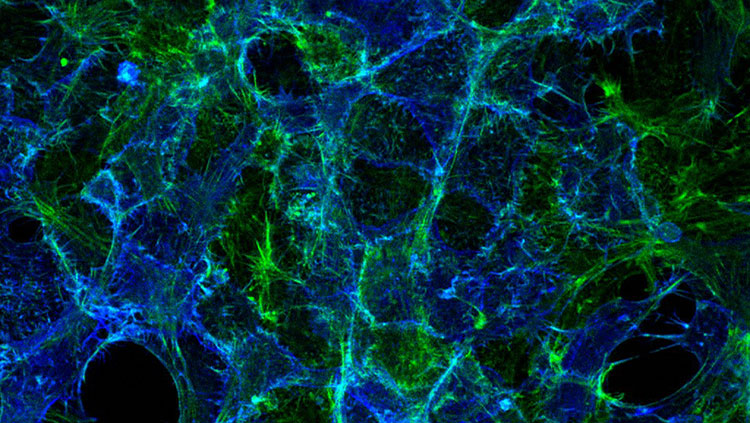 Cells showing serotonin transporter protein