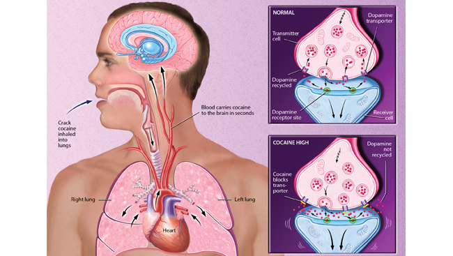 crack cocaine symptoms and effects body crack cocaine symptoms and effects body