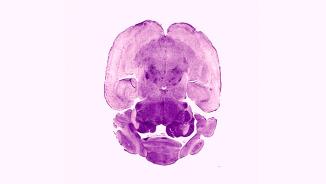 Distribution of orexin-immunoreactive neurons in a horizontal brain slice from an orexin/Halorhodopsin transgenic mouse. 