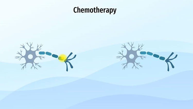 Chemotherapy on the brain