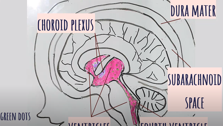 The Watered Down Brain and Hydrocephalus thumbnail