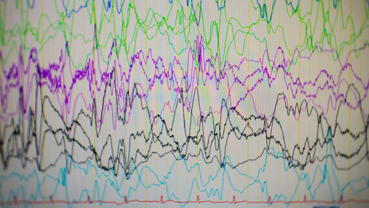 Image of brain waves