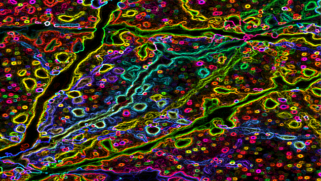 Abnormal dendrites protrude into different areas of the brain.