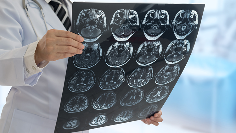 A doctor holding brain scan images