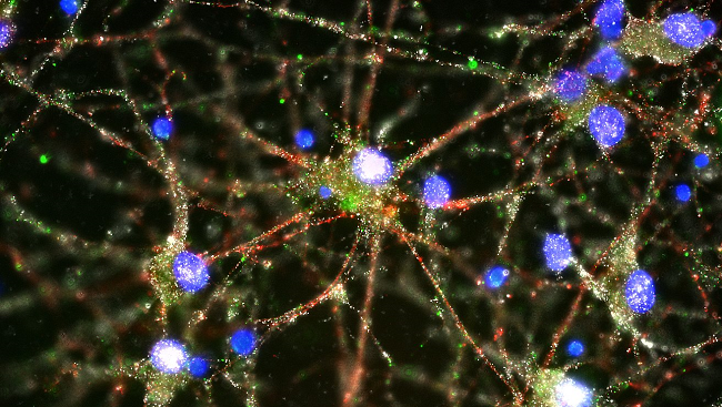 This immune protein (stained green in the micrograph above) helps brain cells prune extra connections or synapses (red and white), indicating this process may go awry in schizophrenia.