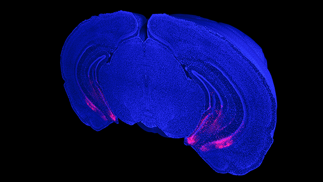 GABA neurons are highlighted in red in the cross-section of a mouse brain.  