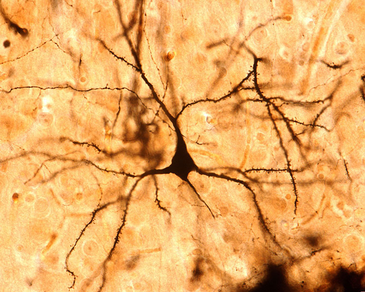 Dendritic Spines 
