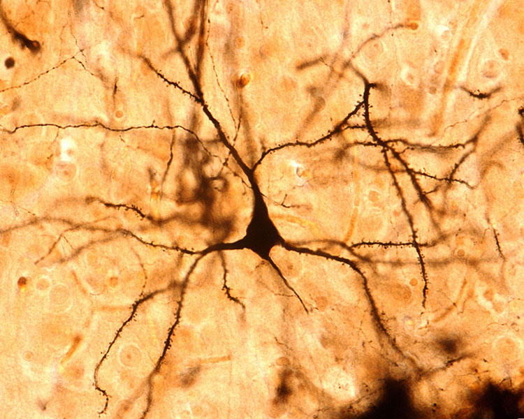 Dendritic Spines