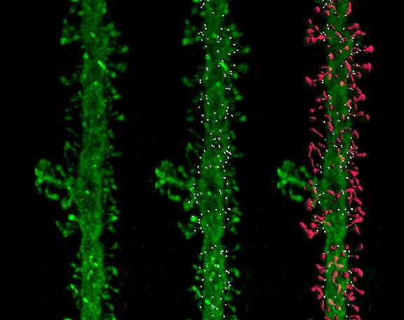 image of dendritic spines