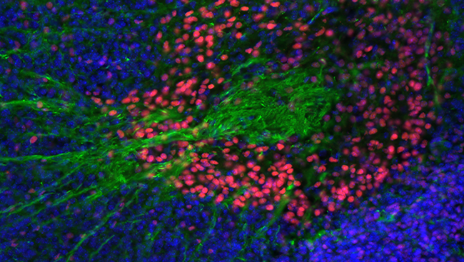 This image highlights the interaction between two structures of the developing basal ganglia in an embryonic mouse. Nerve fibers (green) from one structure called the striatum are making their way toward a structure called the globus pallidus (pink). 