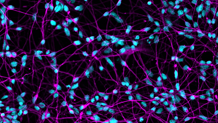 Nuclei of the neurons labeled in blue, while microtubules, which function as cellular scaffolding, are labeled in purple. 