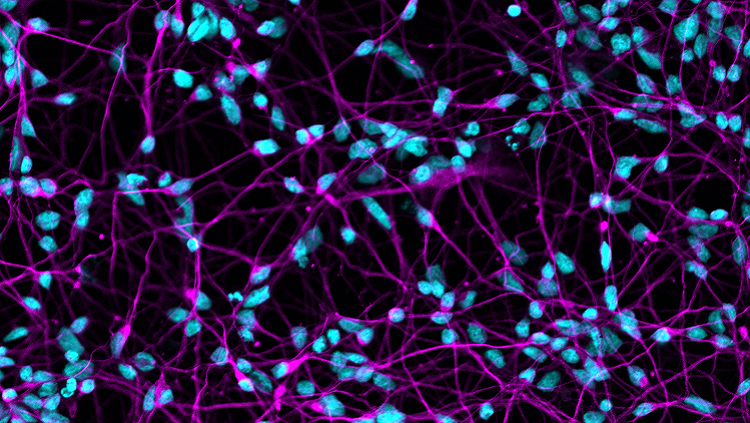 Nuclei of the neurons labeled in blue, while microtubules, which function as cellular scaffolding, are labeled in purple.