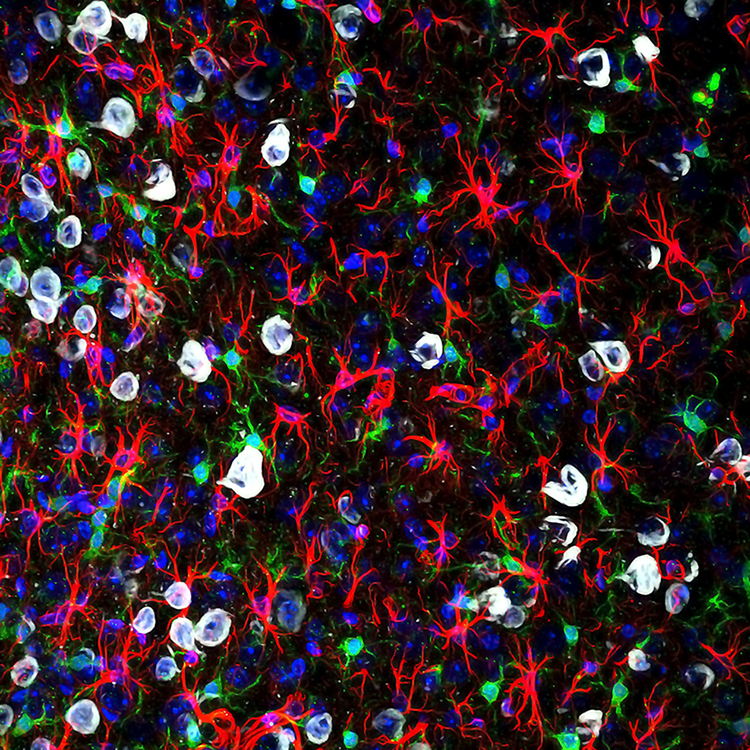 Image of astrocytes and microglia