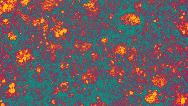Prion particles.