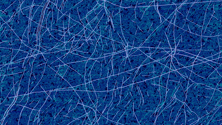 Image of amyloid fibrils seen in a lab sample created on mica 