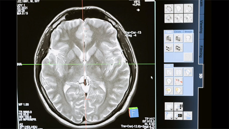 Image of brain scan