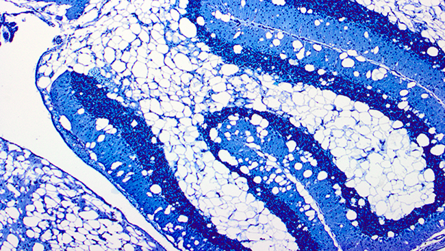 This image shows an area of the brain called the cerebellum in a mouse model of canavan disease, with white spots indicating holes in the myelin. 