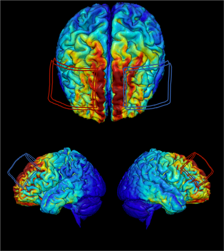 MRI-derived model of brain