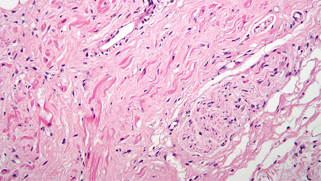 Cross section of the Vagus Nerve. 