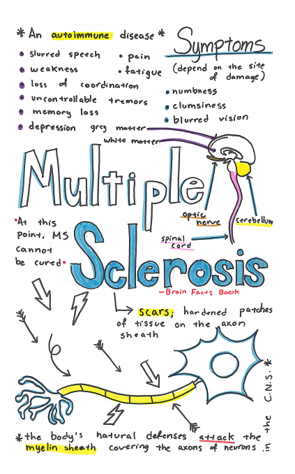 illustrated sketchnote explaining multiple sclerosis