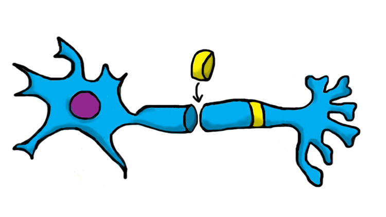 Illustration of a neuron inserted with inulated dough