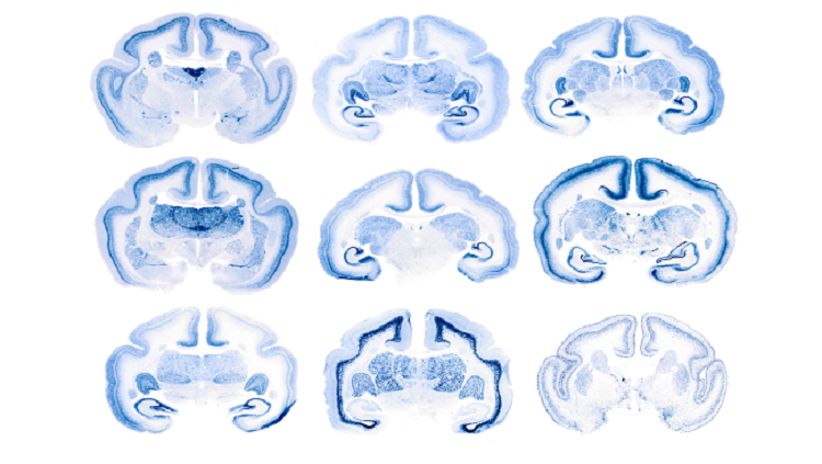 Image of marmoset brains