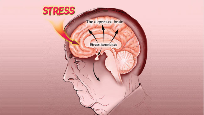 An illustration of the brain pathways involved in stress and depression